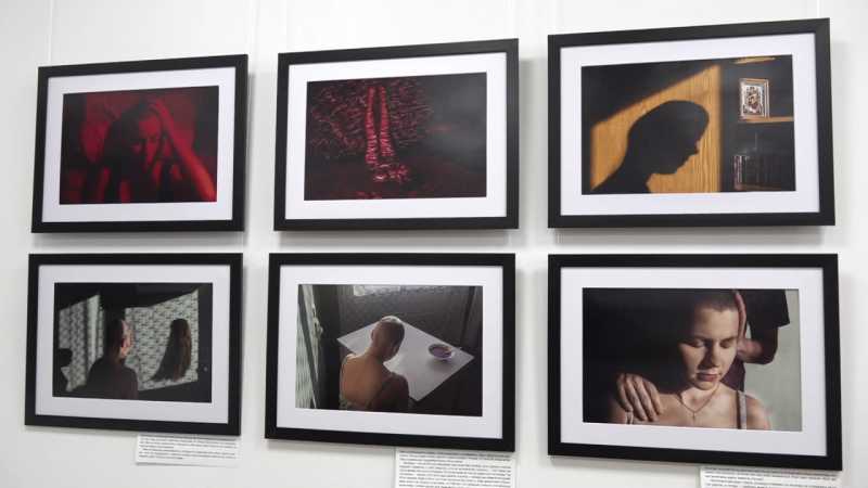 В Белгороде открылась фотовыставка о силе духа и жизни после тяжёлого диагноза