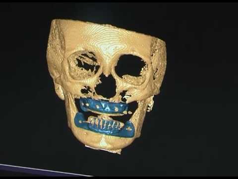 3D-моделирование в стоматологии